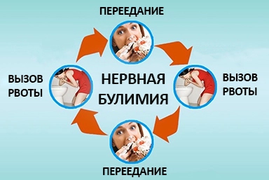 Лечение булимии в Икряном